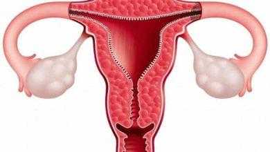 دراسة: الولادة القيصرية ترفع من مخاطر عمليات استئصال الرحم