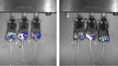 دراسة تمهد الطريق لمنع حدوث الانتكاسات بعد العلاج الإشعاعي للسرطان