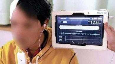 علماء ألمان يتمكنون من تطوير تقنية جديدة لقياس الضغط داخل الجمجمة