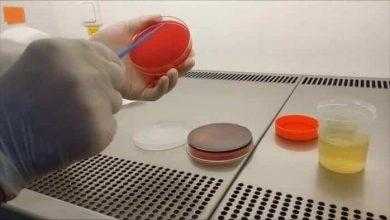 مزرعة البول - Urine Culture