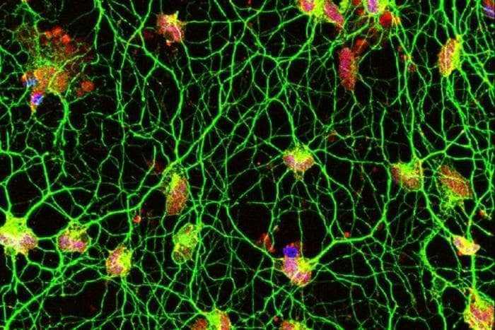 الباحثون يتمكنون من تحويل خلايا الجلد مباشرة إلى خلايا عصبية حركية