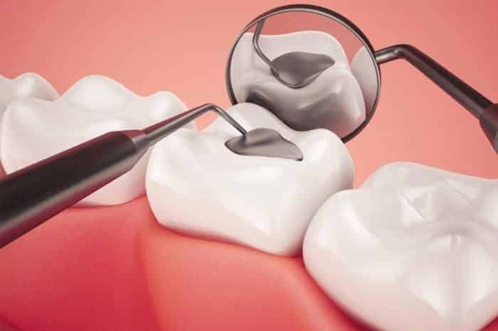 الحشو باستخدام الخلايا الجذعية قد يُمكن الأسنان من الاستشفاء ذاتيا