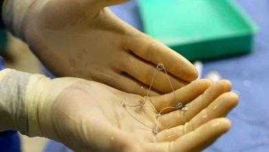 بالفيديو .. كورولا (CORolla) جهاز طبي جديد لعلاج فشل القلب الانبساطي