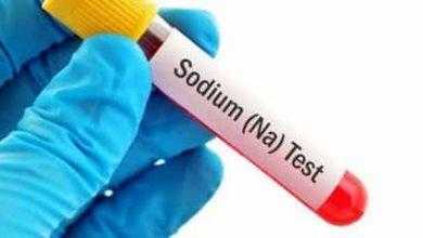 تحليل الصوديوم (Na) في الدم
