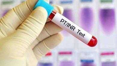 زمن البروثرومبين (Prothrombin Time) .. واختبار الأي إن آر (INR)