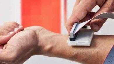 جهاز محمول لتشخيص سرطان الجلد يفوز بجائزة دولية