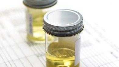 الكلوريد Cl في البول