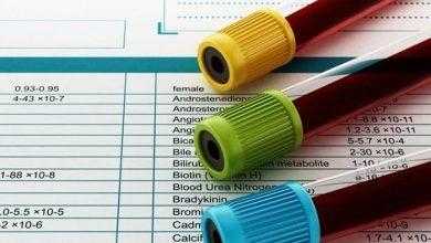 غازات الدم الشرياني Arterial blood gas test ABG
