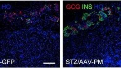 جيني جديد لعلاج مرض السكري من النوع الأول