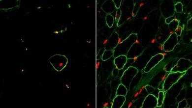 يتمكنون من تخليق العضلات الهيكلية معمليا باستخدام الخلايا الجذعية