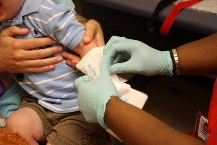 اختبار العرق - Sweat Test اختبار العرق - Sweat Test