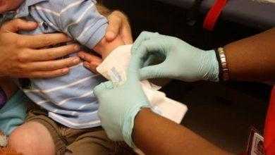 العرق Sweat Test