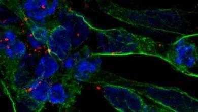 جديد لأنسجة الدماغ التالفة باستخدام الخلايا الجذعية