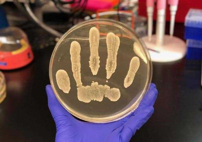 دراسة تكشف دور بكتيريا الجلد في الحماية من الأورام السرطانية دراسة تكشف دور بكتيريا الجلد في الحماية من الأورام السرطانية