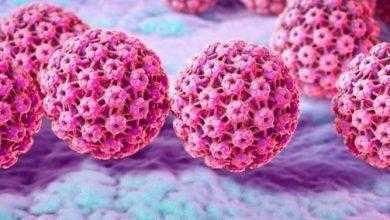 قد تُصبح البلد الأولى عالمياً التي تخلو من سرطان عنق الرحم