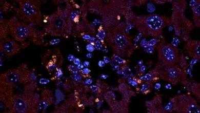 جديد قد يغير من آليات علاج أمراض المناعة الذاتية