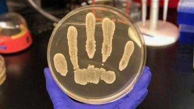 تكشف دور بكتيريا الجلد في الحماية من الأورام السرطانية