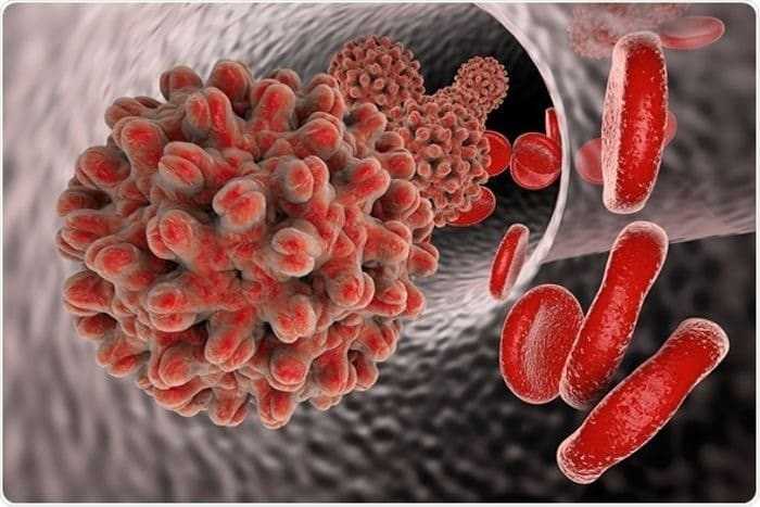 تحليل فائق الحساسية للكشف عن عدوى الالتهاب الكبدي الوبائي (بي) تحليل فائق الحساسية للكشف عن عدوى الالتهاب الكبدي الوبائي (بي)