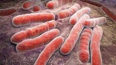 جديد يتنبأ بالإصابة بمرض السل قبل ظهور أعراضه بـعامين