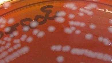 من الهلع في الأوساط الطبية بعد الكشف عن مصاب بالسيلان