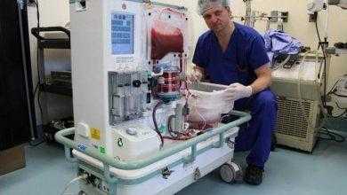 واعدة لتقنية جديدة تستخدم لحفظ الأعضاء قبل زراعتها