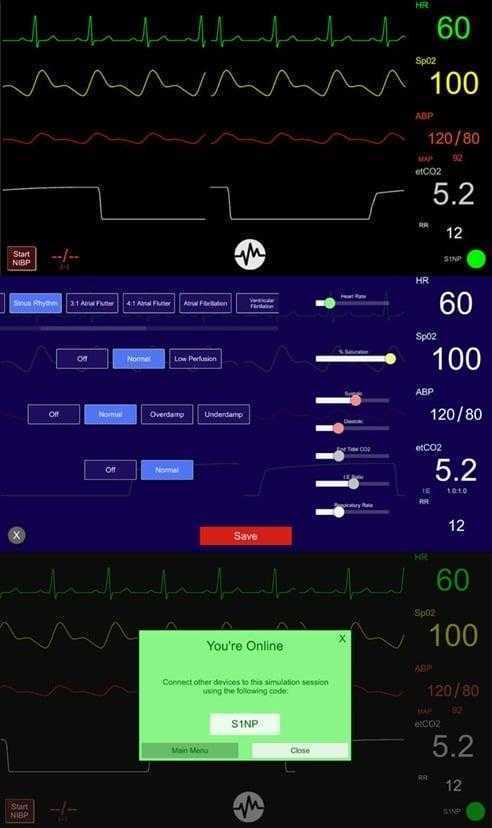 برنامج Simpl - Simulated Patient Monitor لمحاكاة جهاز مراقبة المريض
