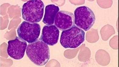 b b b b دراسة جديدة تشير إلى إمكانية الوقاية من سرطان الدم الأشد خطورة في الأطفال