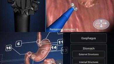 برنامج التنظير ثلاثي الأبعاد - Endoscopy 3D