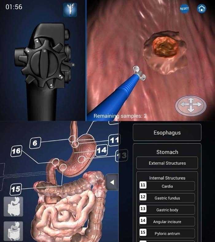 برنامج التنظير ثلاثي الأبعاد Endoscopy 3d الطبي دليل الدواء