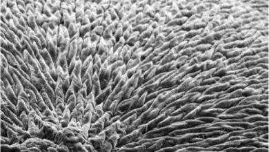 مادة جديدة تساعد على تجديد مينا الأسنان ومنع التسوس