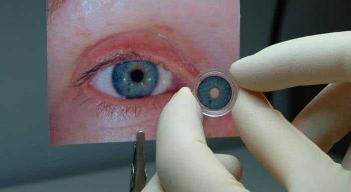 الغذاء والدواء توافق على استخدام أول قزحية اصطناعية في العالم الغذاء والدواء توافق على استخدام أول قزحية اصطناعية في العالم