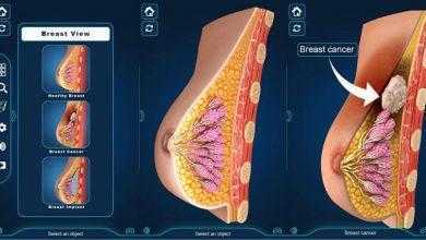 برنامج التركيب التشريحي للثدي – Breast Anatomy