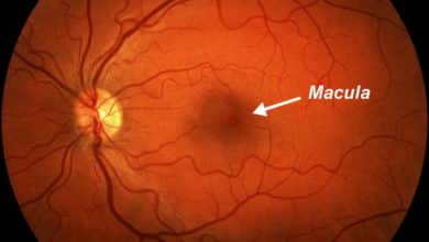 دراسة: تناول برتقالة يومياً يحمي من الإصابة بالتنكس البقعي للعين