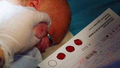 اختبار بيلة الفينيل كيتون – phenylketonuria test
