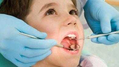 علماء يستخدمون الخلايا الجذعية للأسنان اللبنية لإصلاح تلف الأسنان الدائمة
