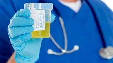 اختبار بول لتشخيص سرطان المبيض يمكنه أن يحسن معدلات البقاء بشكل جذري