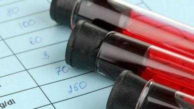 دراسة: نهج جديد للكشف عن السرطان في وقت مبكر عن اختبارات الدم