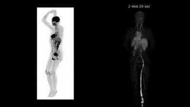 ماسح ضوئي للجسم ثلاثي الأبعاد يمكنه تصوير داخل جسم الإنسان بأكمله في أقل من 20 ثانية