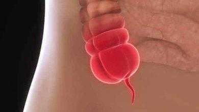 هل توجد علاقة بين الزائدة الدودية ومرض باركنسون ؟