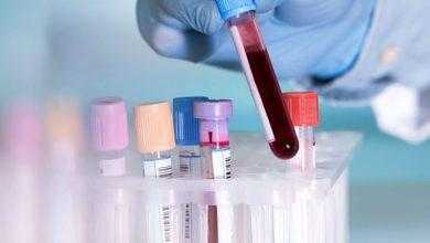 اختبار للدم يمكنه الكشف عن السرطان خلال 10 دقائق