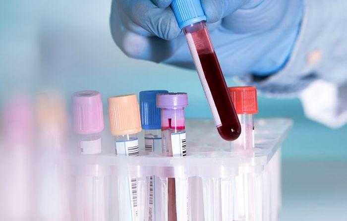 اختبار للدم يمكنه الكشف عن السرطان