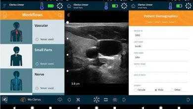 تطبيق كلاريوس للموجات فوق الصوتية - Clarius Ultrasound App