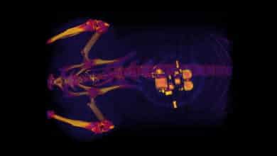 جهاز صغير قابل للزرع يستخدم الضوء لعلاج مشاكل المثانة