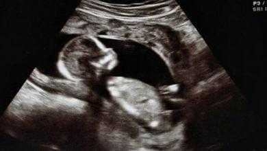 اكتشاف هرمون قد يساعد في تهيئة بطانة الرحم لاستقبال الحمل