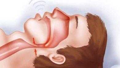 دراسة: انقطاع النفس النومي قد يزيد من خطر الإصابة بالسرطان لدى النساء