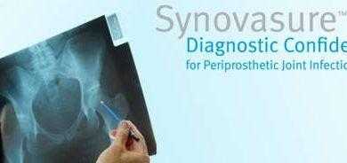 الغذاء والدواء توافق على أول اختبار للكشف عن عدوى المفاصل الاصطناعية