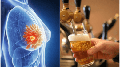تعاطي الكحوليات يزيد خطر الإصابة بسرطان الثدي