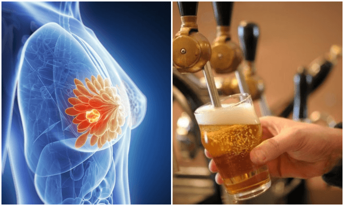 تعاطي الكحوليات يزيد خطر الإصابة بسرطان الثدي
