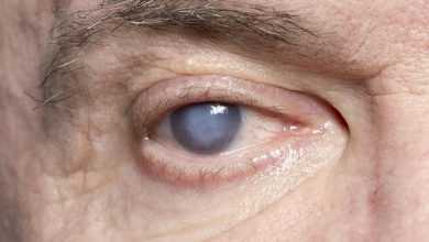 قطرات طبية للعين لعلاج عتامة العدسة