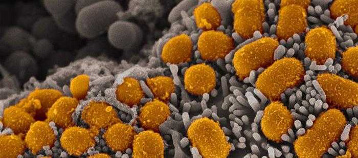 مركب جديد يمنع البكتيريا الخطيرة من مقاومة المضادات الحيوية